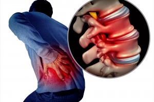 OLIF技術的中國經驗