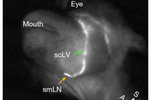 Nature重磅: 頸部按摩就能加速大腦清除垃圾, 預防老年癡呆重大突破!